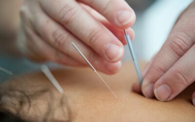Les bienfaits de l&rsquo;acupuncture en parallèle d&rsquo;un accompagnement avec un psychologue du travail